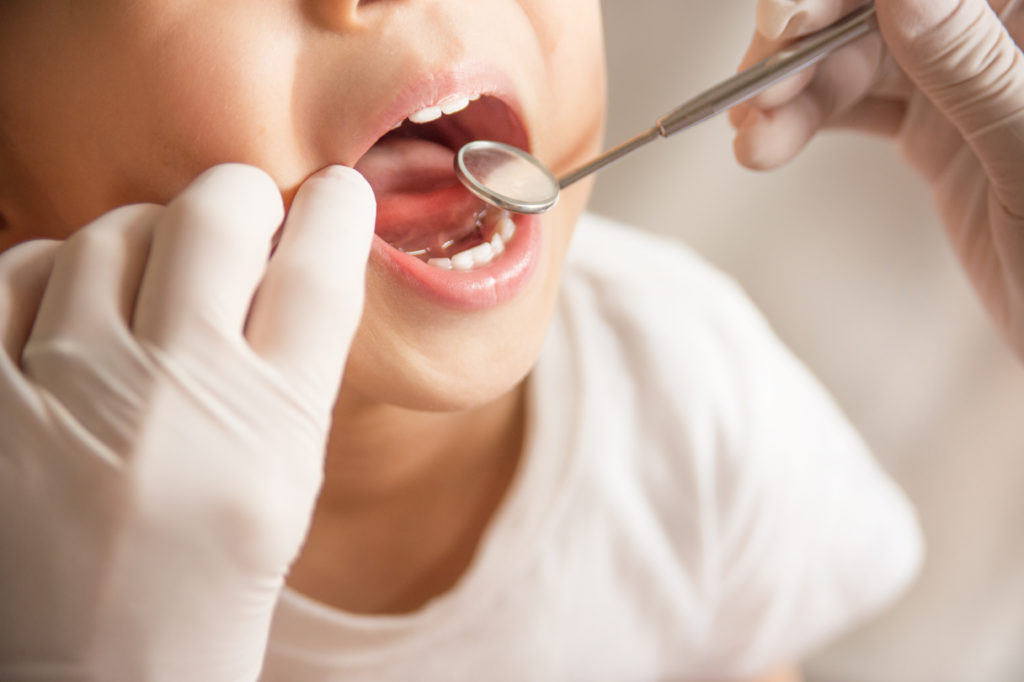 Leczenie ortodontyczne dzieci