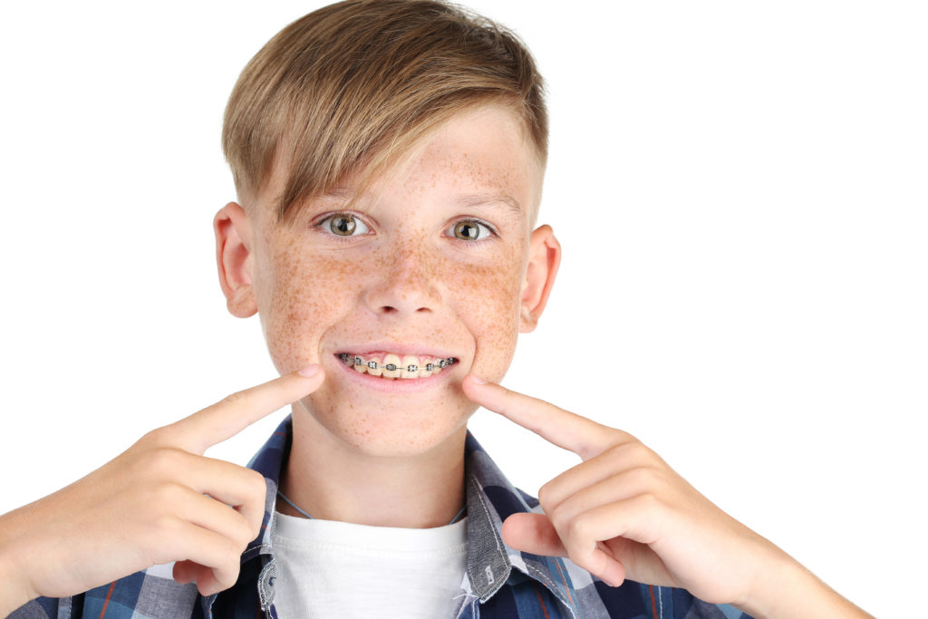 Leczenie ortodontyczne młodzieży